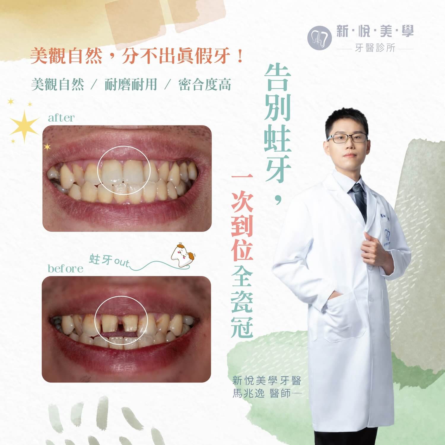 新悅美學牙醫診所的案例分享圖片